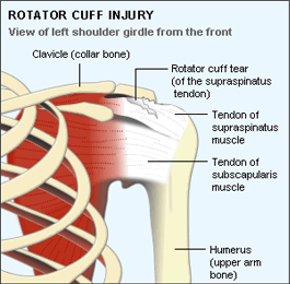 rotator cuff tear diagnosis